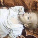 Verminkt door de oorlog: kinderen van Aleppo